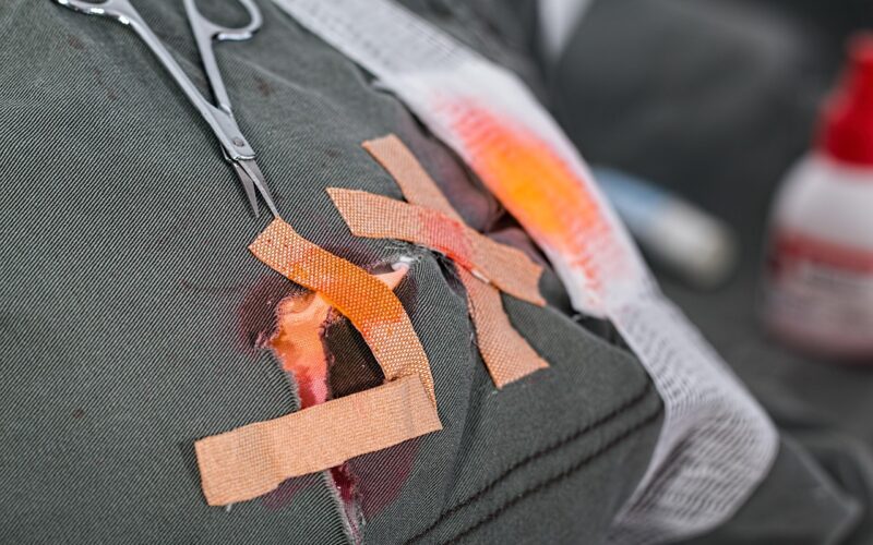 Tenniselleboog door krachttraining hoe behandel je het